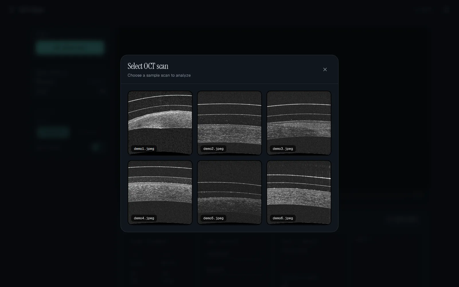OCT Vision demo modal with selectable OCT case images
