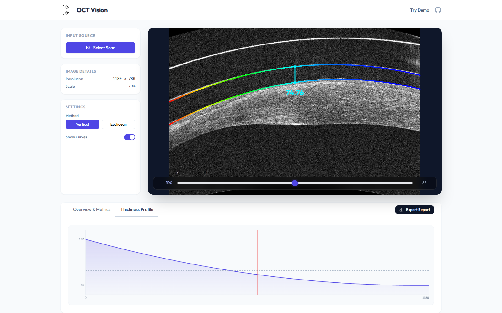 OCT Vision analyzed workspace after selecting a demo OCT image