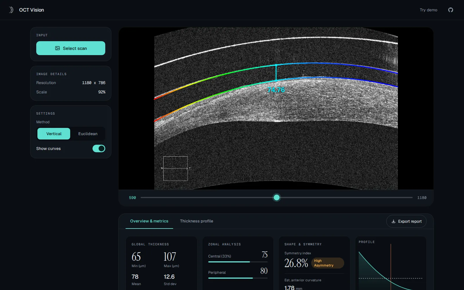 OCT Vision analyzed workspace after selecting a demo OCT image
