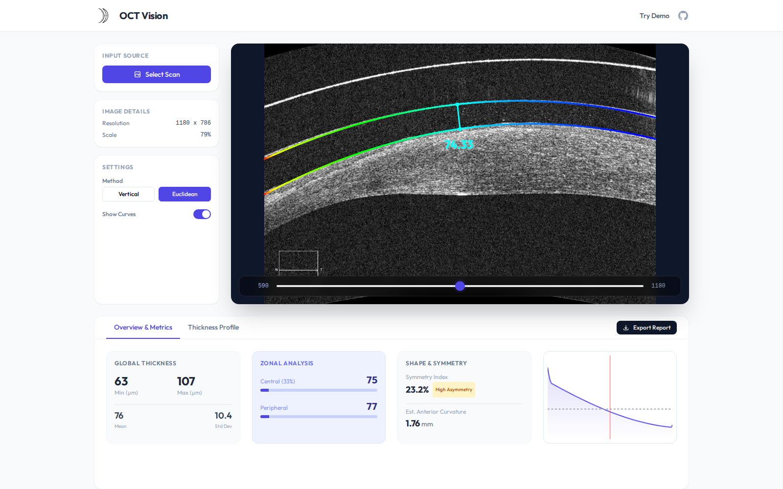 OCT Vision thickness profile tab with computed measurement curve