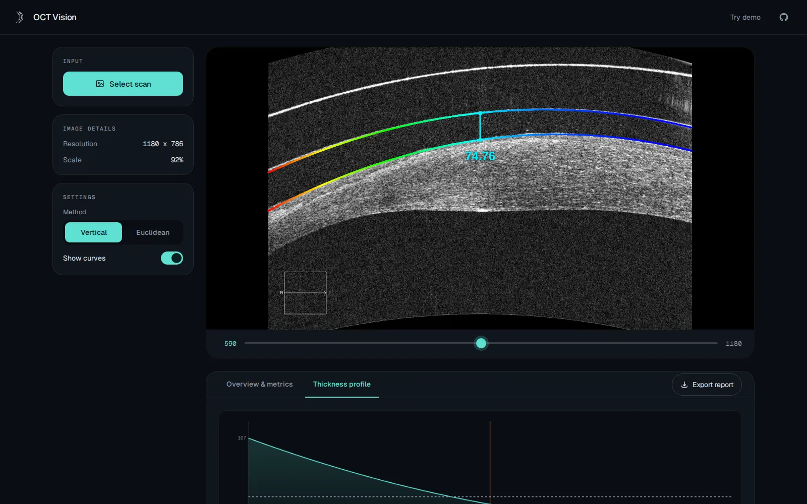 OCT Vision thickness profile tab with computed measurement curve